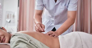 Farmacêuticos Passam a Poder Praticar Acupuntura com Novas Regras