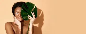Argenx adquire Forte Biosciences por US$ 2,2 bi e fortalece atuação no vitiligo