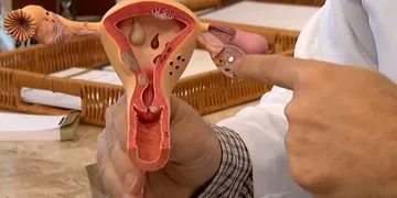 CNPq abre chamada pública de R$ 60 milhões para pesquisas sobre endometriose