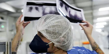 Câncer de pulmão: diagnóstico tardio reduz chances de cura em 90% dos casos
